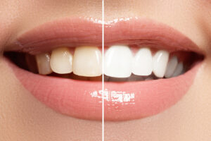 Крем для зубів GC Tooth Mousse 35 мл - Зображення 4