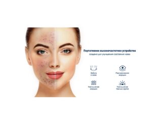 Набор:Ультразвуковой скрабер для лица Medica+ Vibroskin 8.0 + Инструменты для чистки лица (EasyClean) — изображение 4