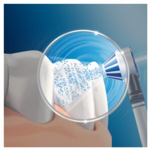 Сменная насадка для ирригатора Oral-B Oxyjet (MD20 OC20 OC501) EB17 — изображение 4